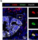 Fig.5.G showing Immunohistochemistry-immunofluorescence in a Homo sapiens (Human) sample from the publication: Single-cell and spatial transcriptomics analysis of non-small cell lung cancer.