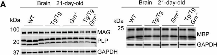 Fig.8.A showing Western Blotting from the publication: Progranulin deficiency does not exacerbate TDP-43 pathology in TDP-43 transgenic mouse models.