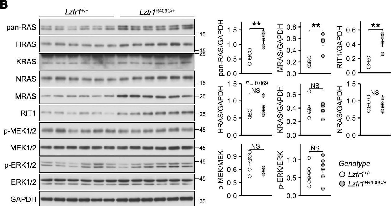 Fig.3.B showing Western Blotting in a Mus musculus (House mouse) sample from the publication: Dysregulation of RAS proteostasis by autosomal-dominant LZTR1 mutation induces Noonan syndrome-like phenotypes in mice.