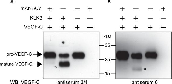Fig.1.A,B showing Western Blotting in a Homo sapiens (Human) sample from the publication: KLK3/PSA and cathepsin D activate VEGF-C and VEGF-D.