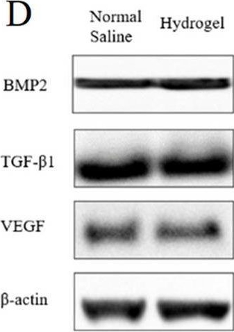 Fig.4.C showing Western Blotting from the publication: Comparison of the effects of hydrogel and normal saline as carriers of MSC on fracture healing in a rat long bone fracture model.