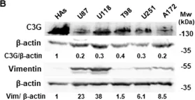 Fig.1.B showing Western Blotting from the publication: C3G downregulation induces the acquisition of a mesenchymal phenotype that enhances aggressiveness of glioblastoma cells.