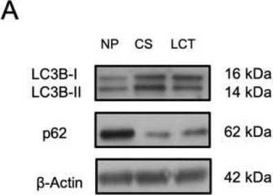Fig.3.A showing Western Blotting in a Homo sapiens (Human) sample from the publication: First Evidence of the Expression and Localization of Prothymosin α in Human Testis and Its Involvement in Testicular Cancers.