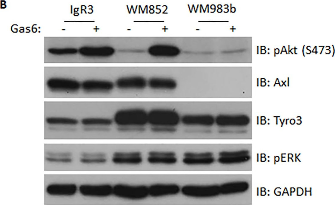 Fig.2.B showing Western Blotting in a Homo sapiens (Human) sample from the publication: Axl contributes to efficient migration and invasion of melanoma cells.