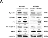 Fig.5.A showing Western Blotting in a Homo sapiens (Human) sample from the publication: MicroRNA-145-5p modulates Krüppel-like factor 5 and inhibits cell proliferation, migration, and invasion in nasopharyngeal carcinoma.