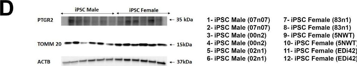 Fig.4.D showing Western Blotting in a Homo sapiens (Human) sample from the publication: Identification of Disease-Relevant, Sex-Based Proteomic Differences in iPSC-Derived Vascular Smooth Muscle Cells.