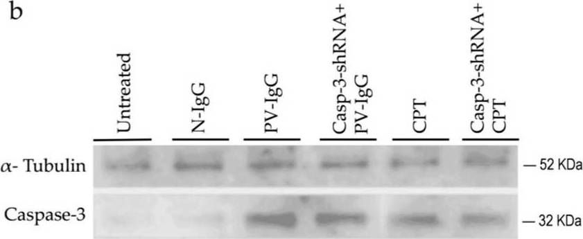 Fig.3.B showing Western Blotting in a Homo sapiens (Human) sample from the publication: shRNA-Targeting Caspase-3 Inhibits Cell Detachment Induced by Pemphigus Vulgaris Autoantibodies in HaCaT Cells.