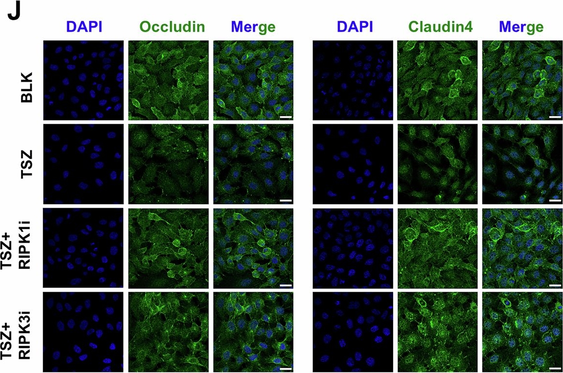 Fig.4.J showing Immunocytochemistry-immunofluorescence from the publication: RIPK3 promotes skin inflammation by enhancing IL-36α signaling and necroptosis in keratinocytes.