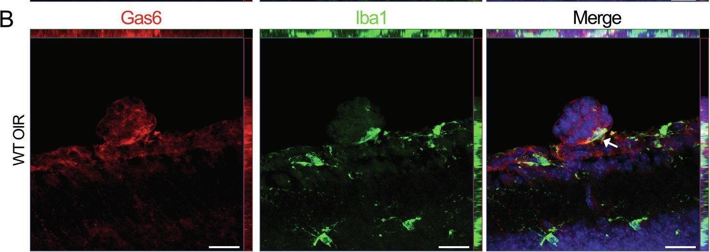 Fig.2.B showing Immunohistochemistry-immunofluorescence in a Mus musculus (House mouse) sample from the publication: Modulation of microglial phagocytosis via the GAS6-MERTK pathway regulates pathological angiogenesis in the mouse oxygen-induced retinopathy model.