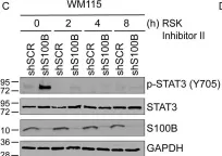 Fig.5.C showing Western Blotting from the publication: The calcium-binding protein S100B reduces IL6 production in malignant melanoma via inhibition of RSK cellular signaling.