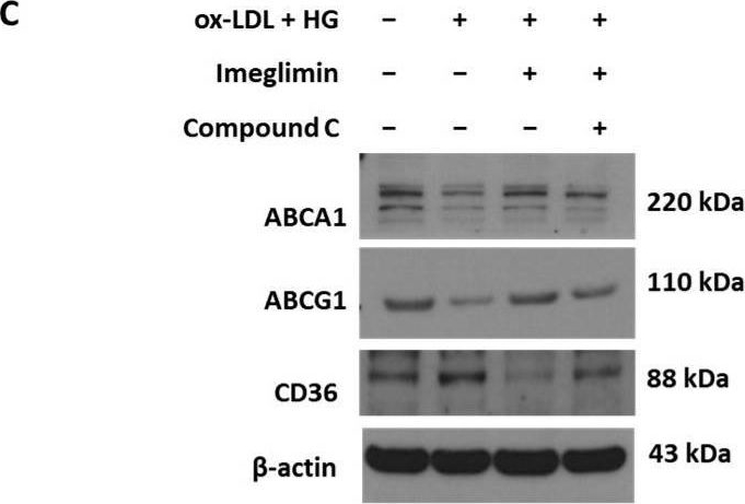 Fig.4.C showing Western Blotting from the publication: Imeglimin Inhibits Macrophage Foam Cell Formation and Atherosclerosis in Streptozotocin-Induced Diabetic ApoE-Deficient Mice.