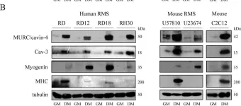 Fig.4.B showing Western Blotting from the publication: MURC/cavin-4 Is Co-Expressed with Caveolin-3 in Rhabdomyosarcoma Tumors and Its Silencing Prevents Myogenic Differentiation in the Human Embryonal RD Cell Line.