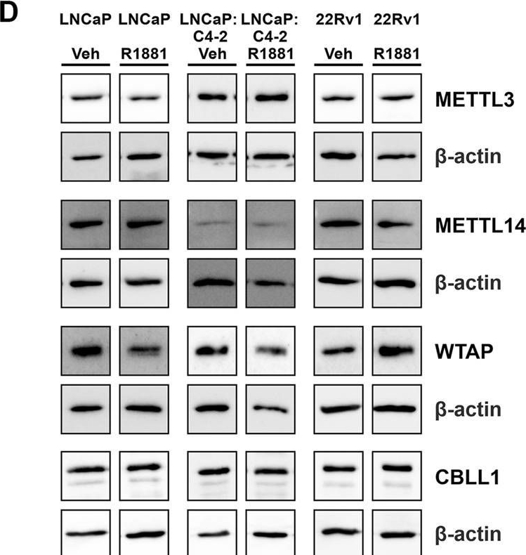 Fig.5.D showing Western Blotting from the publication: Clinical and molecular significance of the RNA m6A methyltransferase complex in prostate cancer.