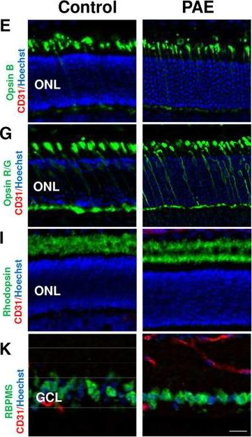 Fig.3.E showing Immunohistochemistry in a Mus musculus (House mouse) sample from the publication: In Utero Alcohol Exposure Impairs Retinal Angiogenesis and the Microvessel-Associated Positioning of Calretinin Interneurons.