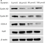 Fig.4.A showing Western Blotting from the publication: Suramin, screened from an approved drug library, inhibits HuR functions and attenuates malignant phenotype of oral cancer cells.