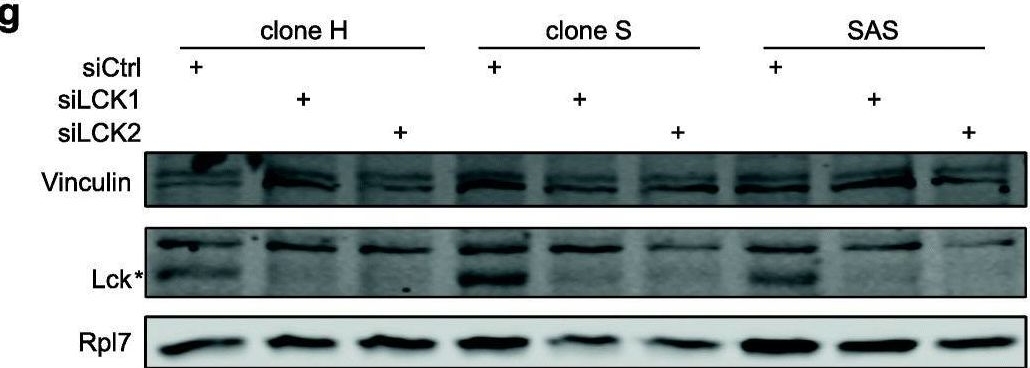 Fig.3.G showing Western Blotting in a Homo sapiens (Human) sample from the publication: Identification of lymphocyte cell-specific protein-tyrosine kinase (LCK) as a driver for invasion and migration of oral cancer by tumor heterogeneity exploitation.