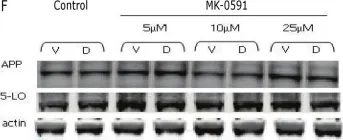 Fig.3.F showing Western Blotting from the publication: Involvement of 5-lipoxygenase in the corticosteroid-dependent amyloid beta formation: in vitro and in vivo evidence.