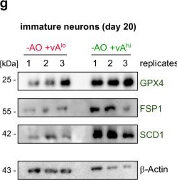 Fig.5.G showing Western Blotting in a Homo sapiens (Human) sample from the publication: Suppression of ferroptosis by vitamin A or radical-trapping antioxidants is essential for neuronal development.