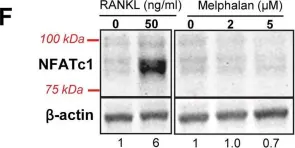 Fig.3.F showing Western Blotting in a Mus musculus (House mouse) sample from the publication: Melphalan modifies the bone microenvironment by enhancing osteoclast formation.