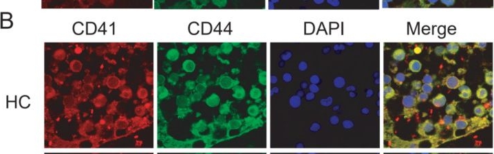 Fig.7.B showing Immunocytochemistry-immunofluorescence in a Homo sapiens (Human) sample from the publication: Single-Cell Analysis Highlights Pivotal Role of Eosinophil-Basophil Mast Cell Progenitor-Related Mechanism in Primary Immune Thrombocytopenia.