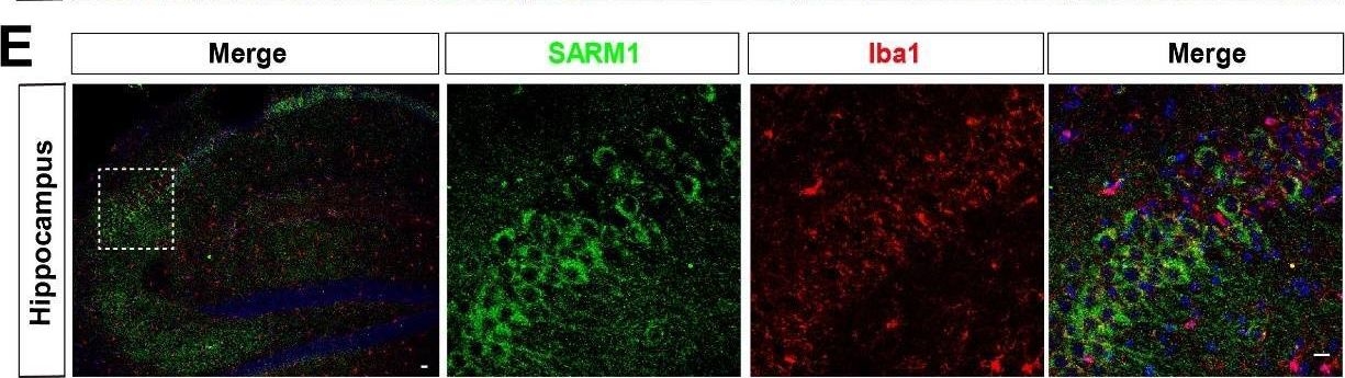 Fig.1.E showing Immunohistochemistry-immunofluorescence in a Mus musculus (House mouse) sample from the publication: SARM1 Promotes Neurodegeneration and Memory Impairment in Mouse Models of Alzheimer's Disease.