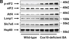 Fig.3.B showing Western Blotting from the publication: Cox10-mediated mitochondrial respiration in brown adipocytes regulates adaptive thermogenesis and systemic metabolism.
