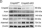 Fig.2.D showing Western Blotting from the publication: CRISPLD2 Attenuates Intervertebral Disc Degeneration by Suppressing Oxidative Stress-Induced Ferroptosis through the miR-548I-IL17A Axis.