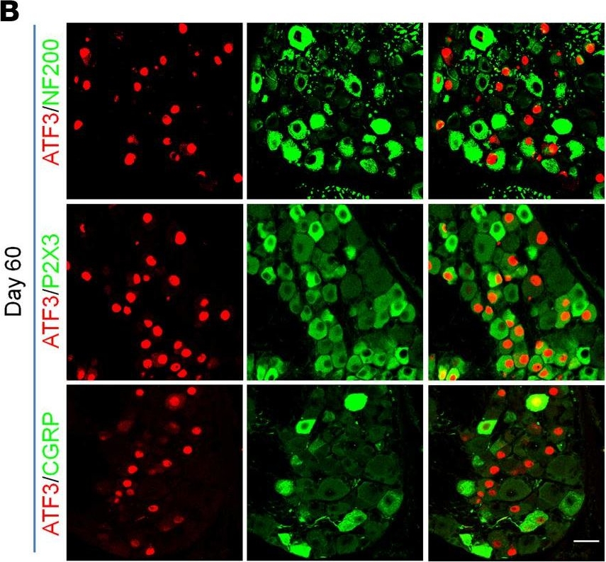Fig.2.B showing Immunohistochemistry in a Mus musculus (House mouse) sample from the publication: Mechanisms and treatments of neuropathic itch in a mouse model of lymphoma.
