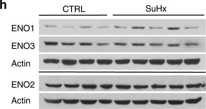 Fig.1.N showing Western Blotting in a Homo sapiens (Human) sample from the publication: Alpha-enolase regulates the malignant phenotype of pulmonary artery smooth muscle cells via the AMPK-Akt pathway.