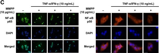 Fig.7.C showing Immunocytochemistry-immunofluorescence in a Homo sapiens (Human) sample from the publication: MMPP Attenuates the Inflammatory Response by Suppressing ROS and Proinflammatory Cytokine and Chemokine Production in TNF-α/IFN-γ-Stimulated Human Keratinocytes.