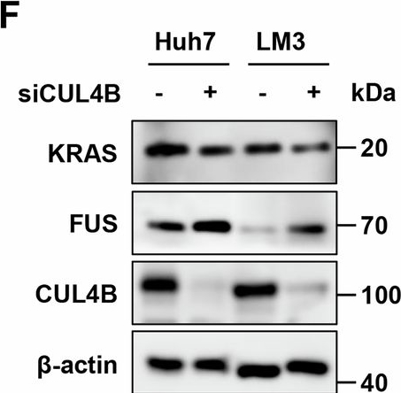 Fig.6.F showing Western Blotting in a Homo sapiens (Human) sample from the publication: CUL4B promotes hepatocellular carcinoma progression and oxaliplatin resistance by facilitating FUS degradation.