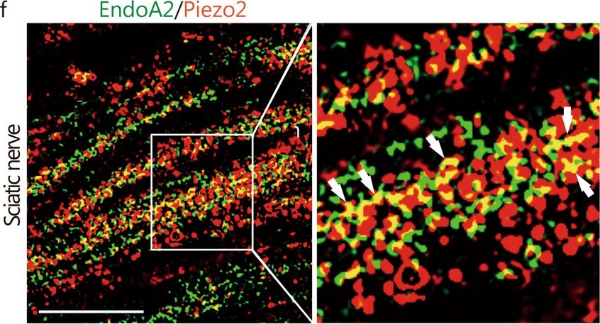 Fig.4.K showing Western Blotting from the publication: Endophilin A2 controls touch and mechanical allodynia via kinesin-mediated Piezo2 trafficking.