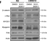 Fig.3.F showing Western Blotting from the publication: Dickkopf-1 Inhibition Reactivates Wnt/β-Catenin Signaling in Rhabdomyosarcoma, Induces Myogenic Markers In Vitro and Impairs Tumor Cell Survival In Vivo.