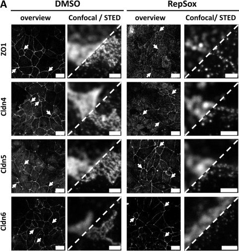 Fig.2.A showing Immunocytochemistry-immunofluorescence from the publication: Nanoscopic analysis of tight junction organization in in vitro blood-brain barrier models.