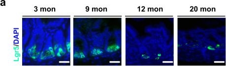 Fig.3.A showing Immunohistochemistry-immunofluorescence in a Mus musculus (House mouse) sample from the publication: Heat-inactivated Bifidobacterium adolescentis ameliorates colon senescence through Paneth-like-cell-mediated stem cell activation.