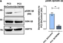Fig.4.A showing Western Blotting from the publication: TRPM4 regulates Akt/GSK3-β activity and enhances β-catenin signaling and cell proliferation in prostate cancer cells.