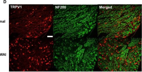 Fig.5.D showing Immunohistochemistry-immunofluorescence in a Rattus norvegicus (Rat) sample from the publication: Attenuation of immobilization stress-induced hypertension by temperature-controllable warm needle acupuncture in rats and the peripheral neural mechanisms.