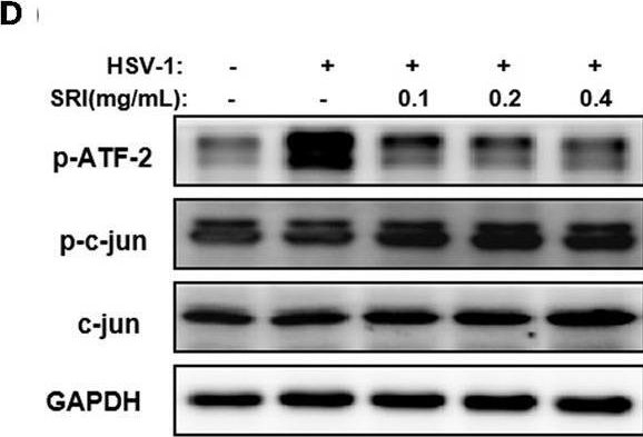 Fig.7.D showing Western Blotting from the publication: Sophoridine Suppresses Herpes Simplex Virus Type 1 Infection by Blocking the Activation of Cellular PI3K/Akt and p38 MAPK Pathways.