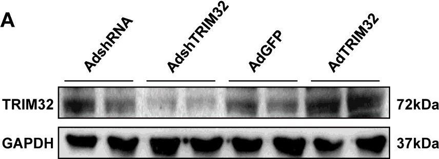 Fig.2.A showing Western Blotting in a Mus musculus (House mouse) sample from the publication: Tripartite motif 32 prevents pathological cardiac hypertrophy.