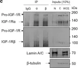 Fig.2.C showing Western Blotting in a Homo sapiens (Human) sample from the publication: IGF-1R nuclear import and recruitment to chromatin involves both alpha and beta subunits.