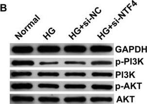 Fig.4.B showing Western Blotting in a Homo sapiens (Human) sample from the publication: Inhibition of NTF4 Attenuates High Glucose-Induced Apoptosis and Inflammation in HTR-8/SVneo Cells via the PI3K/AKT Pathway.