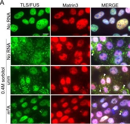 Fig.5.A showing Immunocytochemistry-immunofluorescence from the publication: m6A Modified Short RNA Fragments Inhibit Cytoplasmic TLS/FUS Aggregation Induced by Hyperosmotic Stress.
