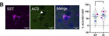 Fig.2.B showing Immunohistochemistry-immunofluorescence from the publication: GPR88 localization to primary cilia in neurons is cell-type specific.