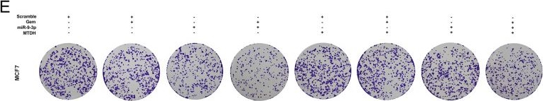Fig.7.E showing Immunohistochemistry from the publication: MiR-9-3p regulates the biological functions and drug resistance of gemcitabine-treated breast cancer cells and affects tumor growth through targeting MTDH.
