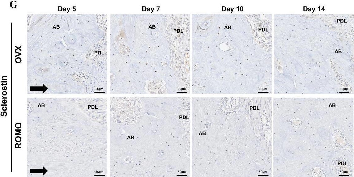 Fig.4.G showing Immunohistochemistry in a Rattus norvegicus (Rat) sample from the publication: Effect of anti-sclerostin antibody on orthodontic tooth movement in ovariectomized rats.