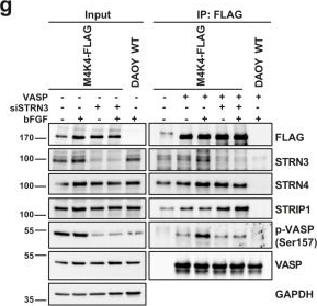 Fig.6.G showing Western Blotting in a Homo sapiens (Human) sample from the publication: Cooperation of Striatin 3 and MAP4K4 promotes growth and tissue invasion.