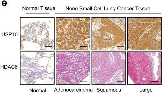 Fig.8.E showing Immunohistochemistry from the publication: The USP10-HDAC6 axis confers cisplatin resistance in non-small cell lung cancer lacking wild-type p53.