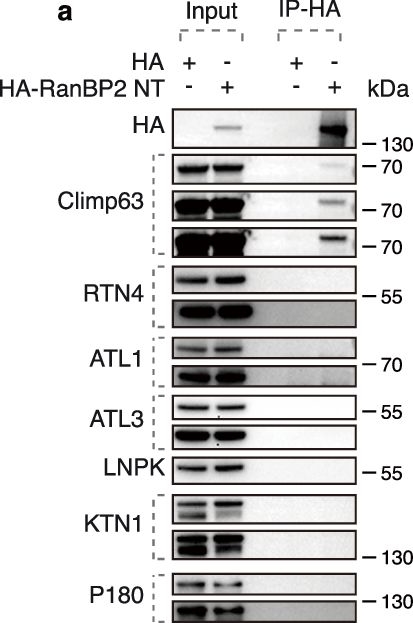 Fig.7.A showing Western Blotting in a Homo sapiens (Human) sample from the publication: RanBP2-dependent annulate lamellae drive nuclear pore assembly and nuclear expansion.
