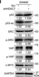 Fig.3.I showing Western Blotting from the publication: HDAC7-Induced Epigenetic Repression Modulates ATF3 Functional Plasticity in Colorectal Cancer Pathogenesis.