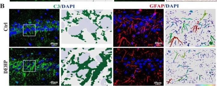 Fig.4.B showing Immunohistochemistry-immunofluorescence in a Rattus norvegicus (Rat) sample from the publication: Integrated Profiling of DEHP-Induced Hippocampal Neurotoxicity in Adult Female Rats Based on Transcriptomic and Neurobiological Analyses.